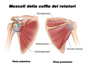 Cuffia rotatori spalla